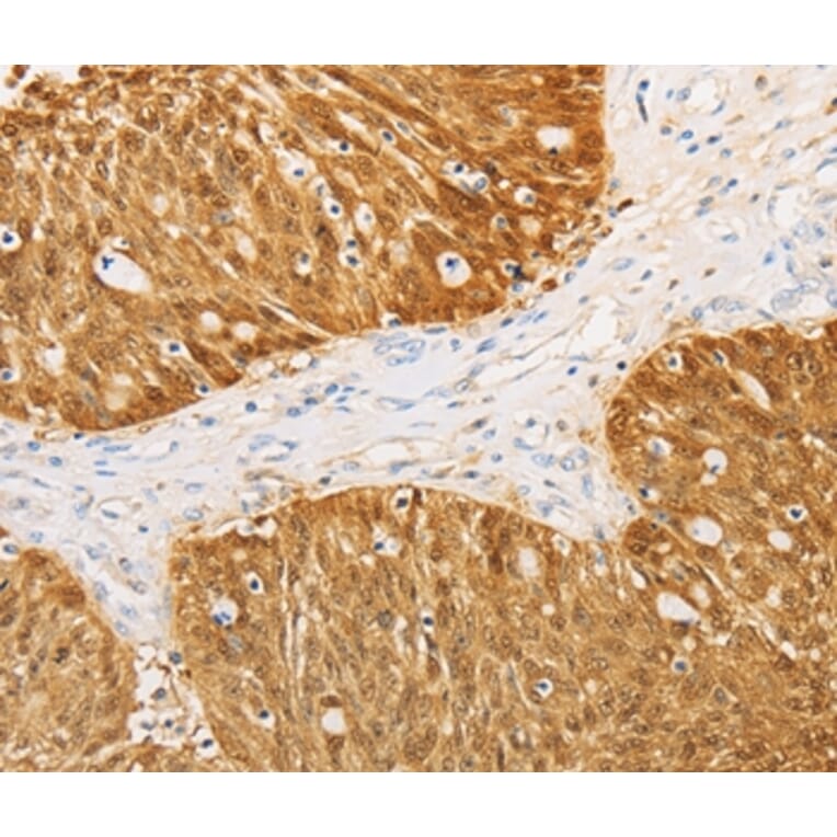 Immunohistochemistry - S100A1 Antibody from Signalway Antibody (35908) - Antibodies.com