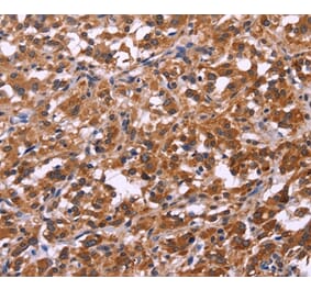 Immunohistochemistry - SPATA7 Antibody from Signalway Antibody (35942) - Antibodies.com