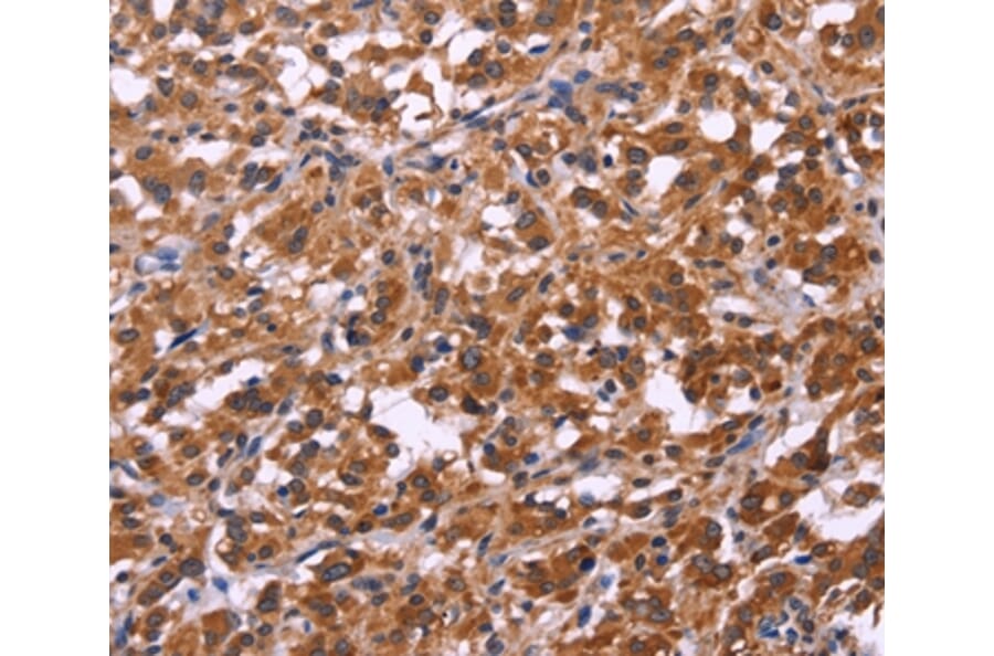 Immunohistochemistry - SPATA7 Antibody from Signalway Antibody (35942) - Antibodies.com
