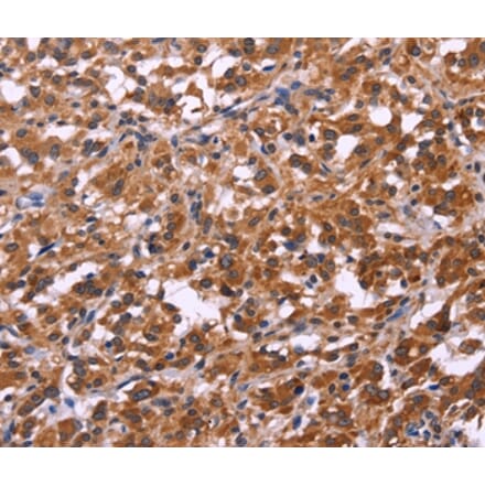 Immunohistochemistry - SPATA7 Antibody from Signalway Antibody (35942) - Antibodies.com