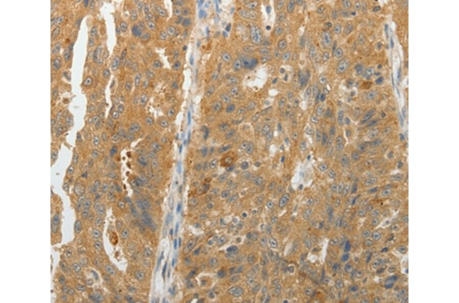 Immunohistochemistry - MAP4K5 Antibody from Signalway Antibody (35950) - Antibodies.com