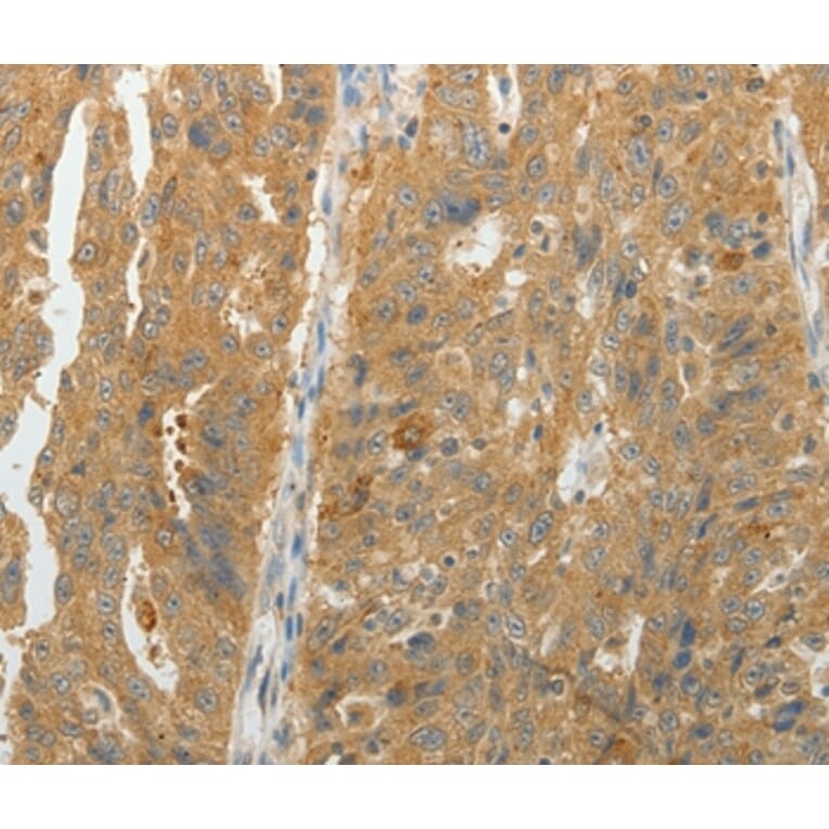 Immunohistochemistry - MAP4K5 Antibody from Signalway Antibody (35950) - Antibodies.com