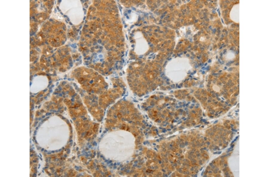 Immunohistochemistry - MAP4K5 Antibody from Signalway Antibody (35950) - Antibodies.com