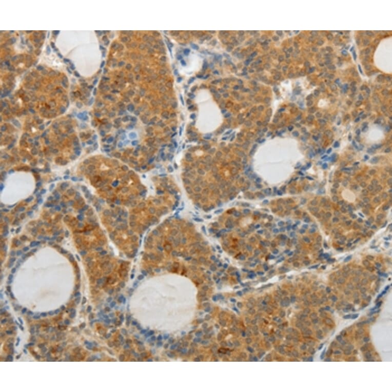 Immunohistochemistry - MAP4K5 Antibody from Signalway Antibody (35950) - Antibodies.com