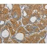 Immunohistochemistry - MAP4K5 Antibody from Signalway Antibody (35950) - Antibodies.com