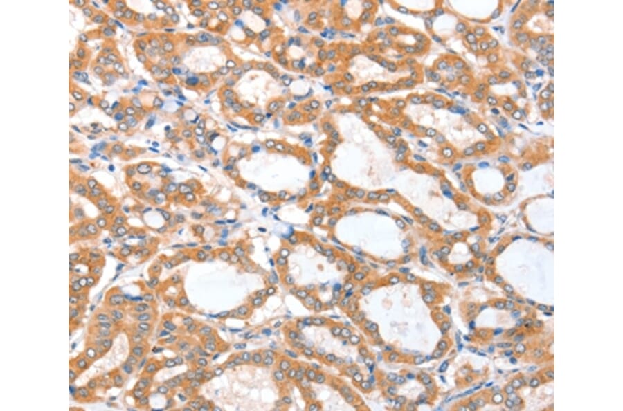 Immunohistochemistry - ACSBG1 Antibody from Signalway Antibody (36024) - Antibodies.com