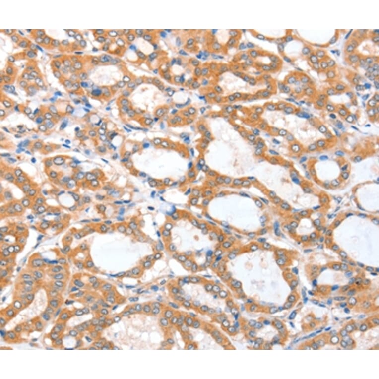 Immunohistochemistry - ACSBG1 Antibody from Signalway Antibody (36024) - Antibodies.com