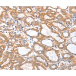 Immunohistochemistry - ACSBG1 Antibody from Signalway Antibody (36024) - Antibodies.com
