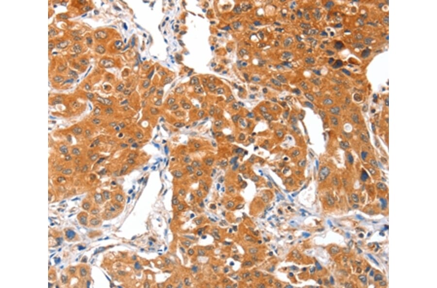 Immunohistochemistry - ACSBG1 Antibody from Signalway Antibody (36024) - Antibodies.com