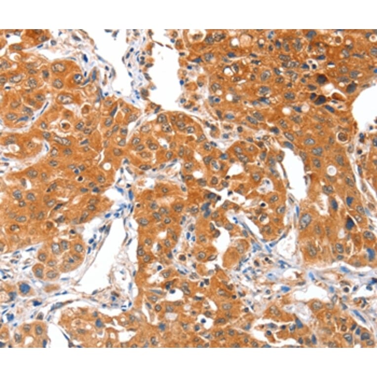 Immunohistochemistry - ACSBG1 Antibody from Signalway Antibody (36024) - Antibodies.com