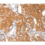 Immunohistochemistry - ACSBG1 Antibody from Signalway Antibody (36024) - Antibodies.com