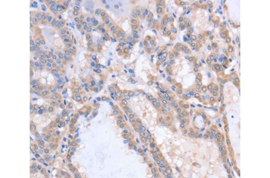 Immunohistochemistry - ACVR1C Antibody from Signalway Antibody (36028) - Antibodies.com