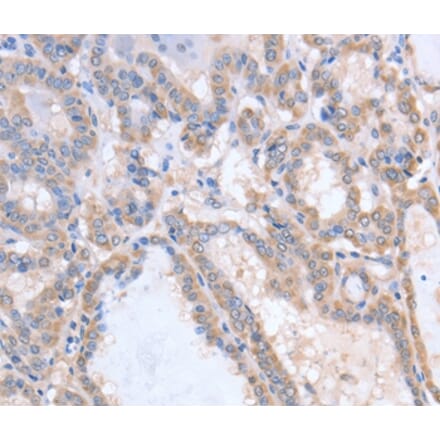 Immunohistochemistry - ACVR1C Antibody from Signalway Antibody (36028) - Antibodies.com