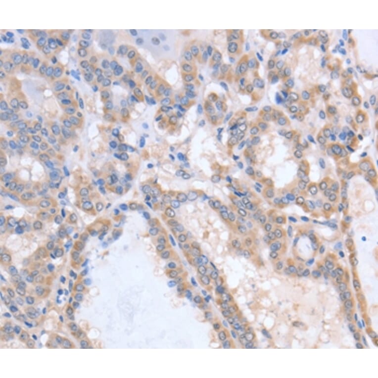 Immunohistochemistry - ACVR1C Antibody from Signalway Antibody (36028) - Antibodies.com
