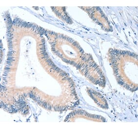 Immunohistochemistry - ACTL7B Antibody from Signalway Antibody (36029) - Antibodies.com