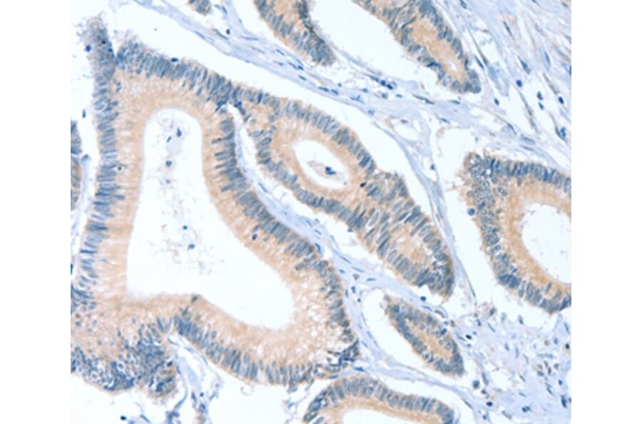 Immunohistochemistry - ACTL7B Antibody from Signalway Antibody (36029) - Antibodies.com
