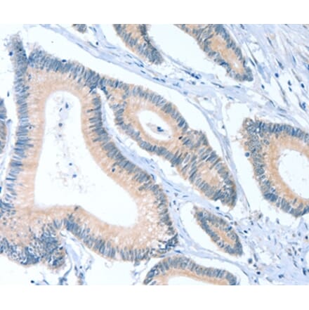 Immunohistochemistry - ACTL7B Antibody from Signalway Antibody (36029) - Antibodies.com