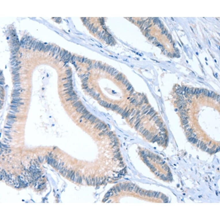 Immunohistochemistry - ACTL7B Antibody from Signalway Antibody (36029) - Antibodies.com