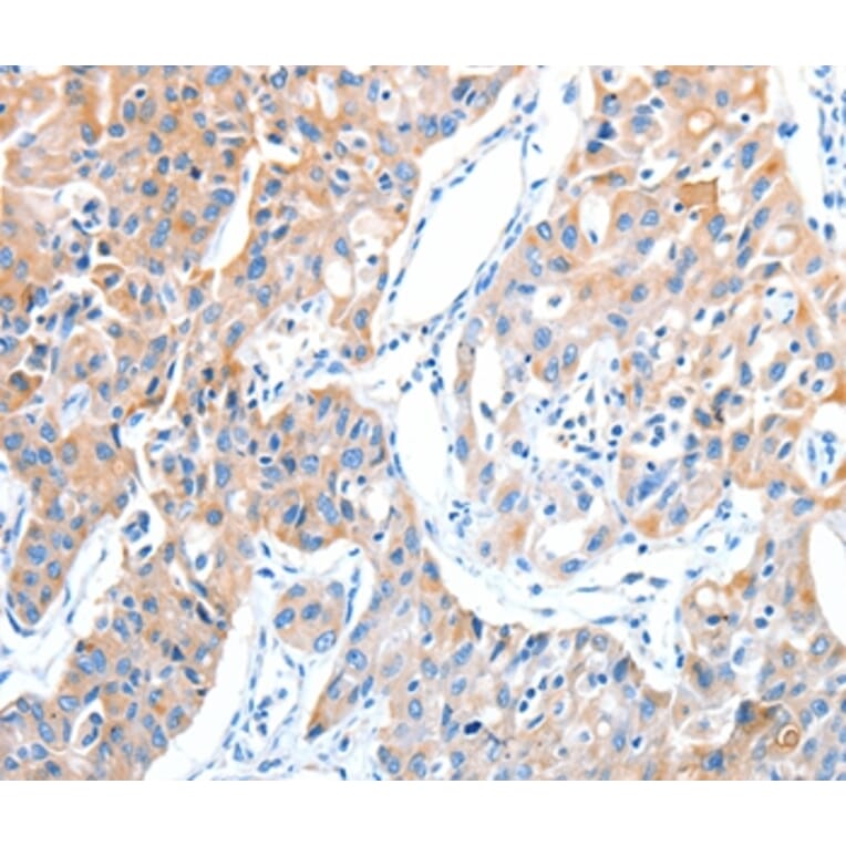 Immunohistochemistry - ADAM17 Antibody from Signalway Antibody (36043) - Antibodies.com