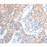 Immunohistochemistry - ADAM17 Antibody from Signalway Antibody (36043) - Antibodies.com