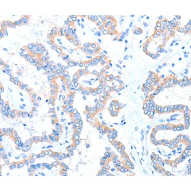 Immunohistochemistry - ADAM17 Antibody from Signalway Antibody (36043) - Antibodies.com