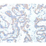 Immunohistochemistry - ADAM17 Antibody from Signalway Antibody (36043) - Antibodies.com