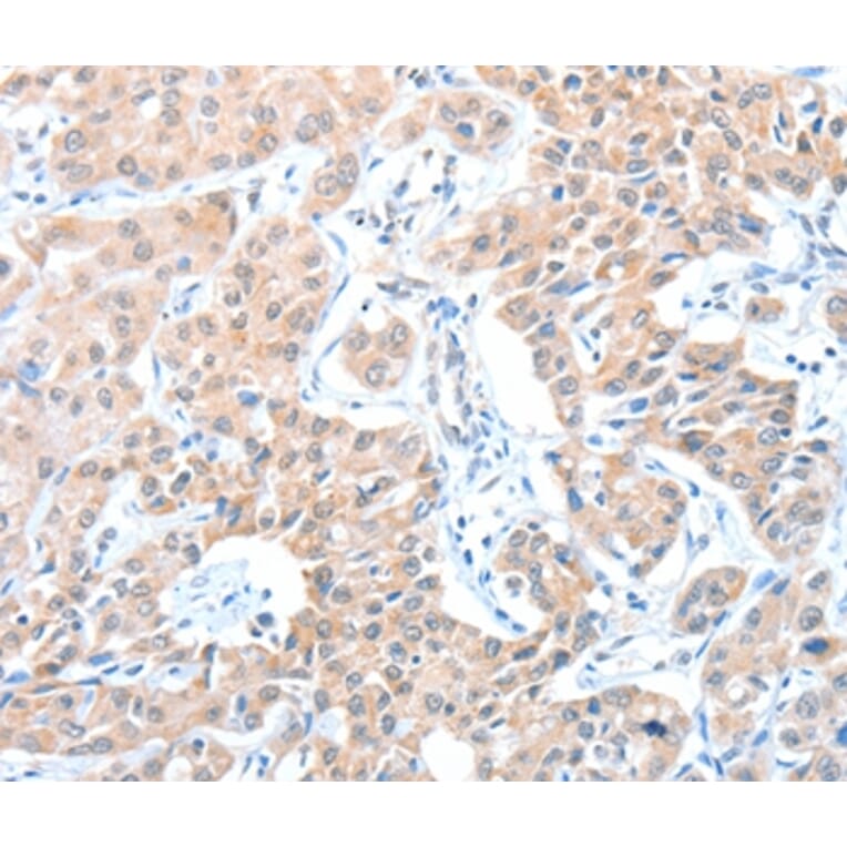 Immunohistochemistry - ADAM21 Antibody from Signalway Antibody (36044) - Antibodies.com