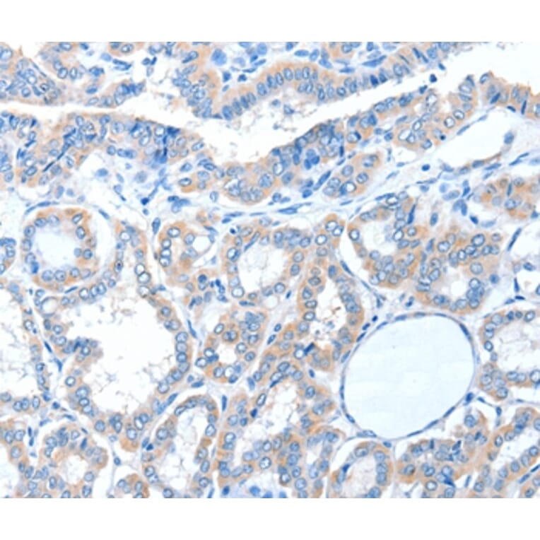 Immunohistochemistry - ADAM21 Antibody from Signalway Antibody (36044) - Antibodies.com