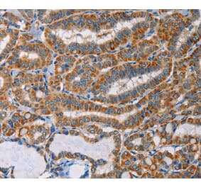 Immunohistochemistry - AGPAT4 Antibody from Signalway Antibody (36063) - Antibodies.com