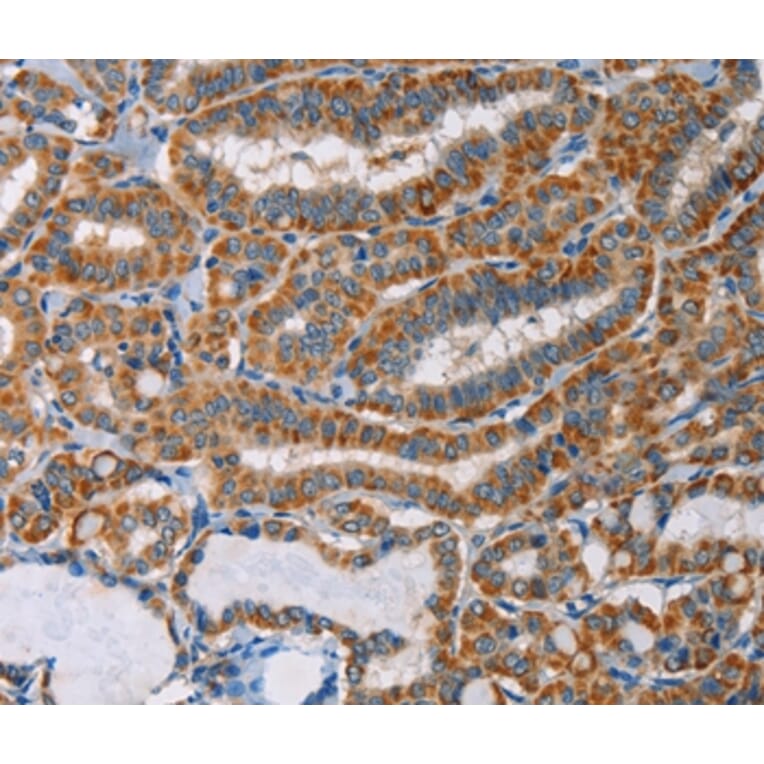 Immunohistochemistry - AGPAT4 Antibody from Signalway Antibody (36063) - Antibodies.com