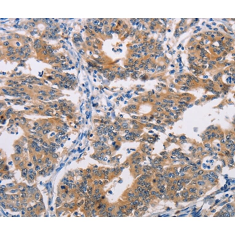 Immunohistochemistry - AGPAT4 Antibody from Signalway Antibody (36063) - Antibodies.com