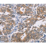 Immunohistochemistry - AGPAT4 Antibody from Signalway Antibody (36063) - Antibodies.com