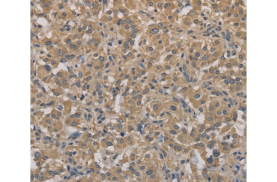 Immunohistochemistry - AGTRAP Antibody from Signalway Antibody (36065) - Antibodies.com