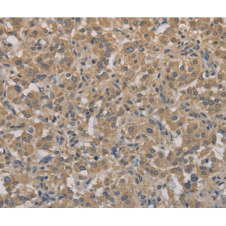 Immunohistochemistry - AGTRAP Antibody from Signalway Antibody (36065) - Antibodies.com