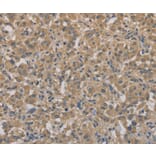 Immunohistochemistry - AGTRAP Antibody from Signalway Antibody (36065) - Antibodies.com