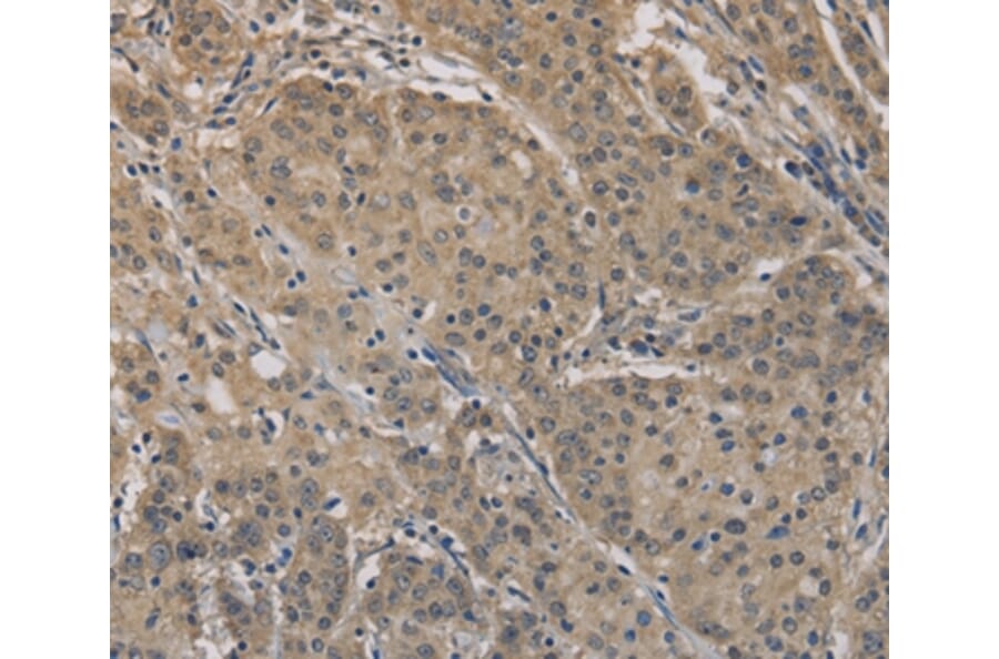 Immunohistochemistry - AGTRAP Antibody from Signalway Antibody (36065) - Antibodies.com