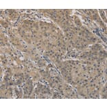 Immunohistochemistry - AGTRAP Antibody from Signalway Antibody (36065) - Antibodies.com