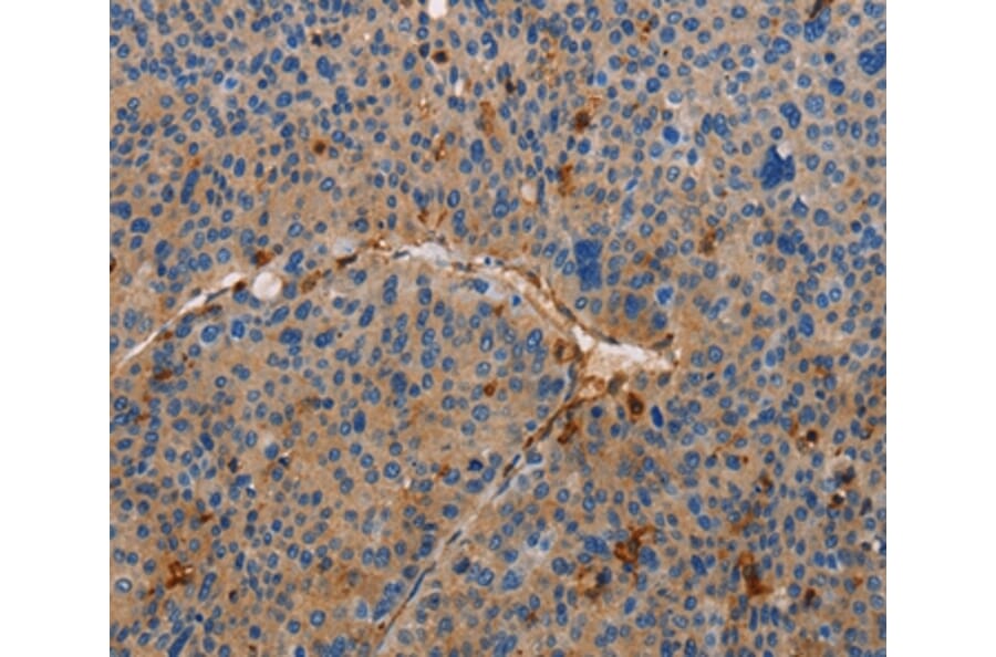 Immunohistochemistry - AMBRA1 Antibody from Signalway Antibody (36091) - Antibodies.com