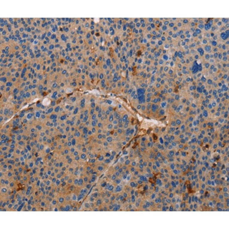 Immunohistochemistry - AMBRA1 Antibody from Signalway Antibody (36091) - Antibodies.com
