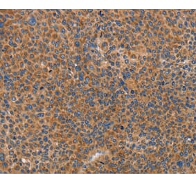 Immunohistochemistry - PRKAA2 Antibody from Signalway Antibody (36097) - Antibodies.com