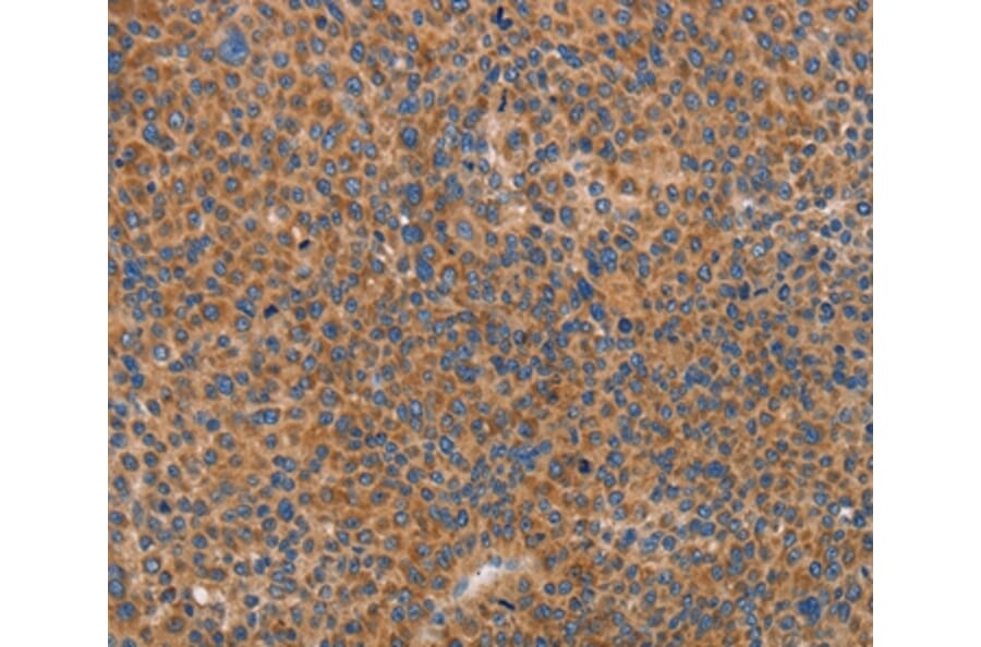 Immunohistochemistry - PRKAA2 Antibody from Signalway Antibody (36097) - Antibodies.com