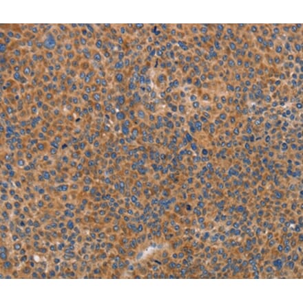 Immunohistochemistry - PRKAA2 Antibody from Signalway Antibody (36097) - Antibodies.com