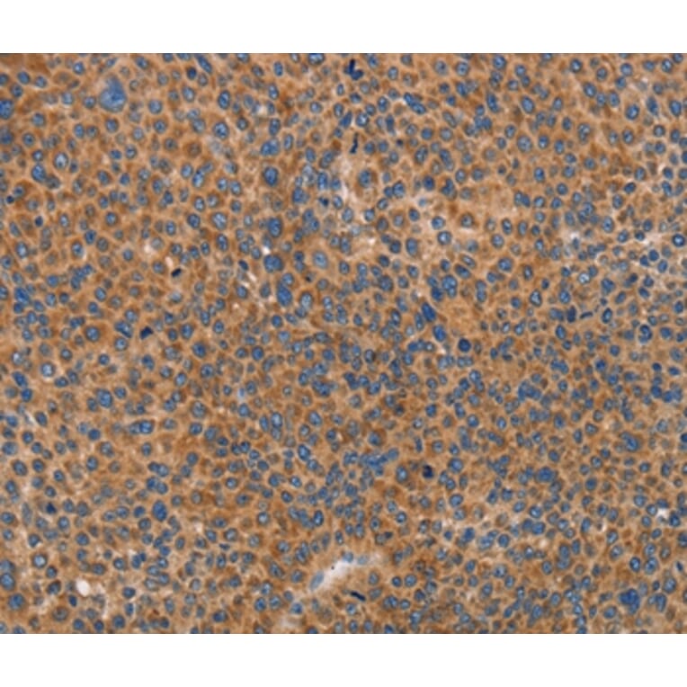 Immunohistochemistry - PRKAA2 Antibody from Signalway Antibody (36097) - Antibodies.com
