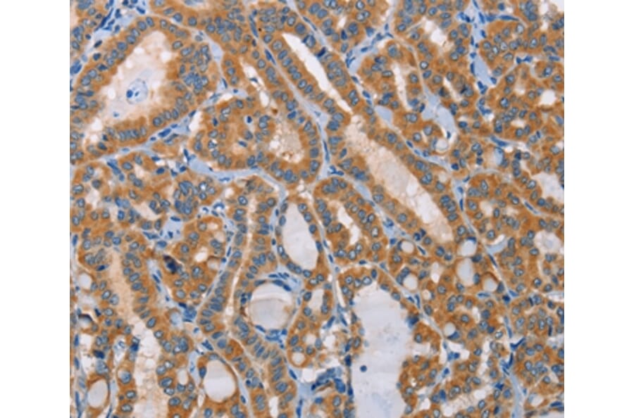Immunohistochemistry - PRKAA2 Antibody from Signalway Antibody (36097) - Antibodies.com