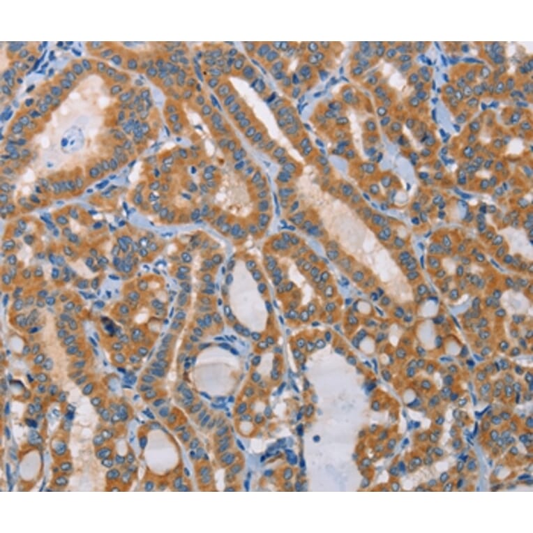 Immunohistochemistry - PRKAA2 Antibody from Signalway Antibody (36097) - Antibodies.com