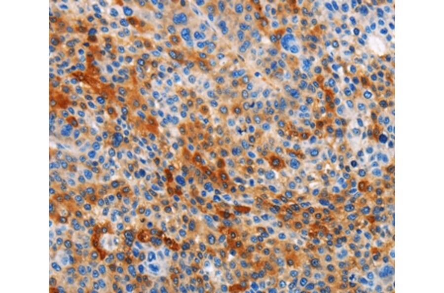 Immunohistochemistry - STAMBP Antibody from Signalway Antibody (36099) - Antibodies.com