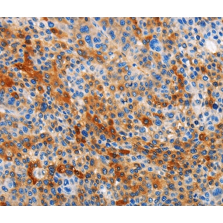 Immunohistochemistry - STAMBP Antibody from Signalway Antibody (36099) - Antibodies.com