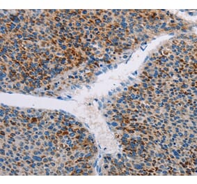 Immunohistochemistry - AMOTL2 Antibody from Signalway Antibody (36101) - Antibodies.com