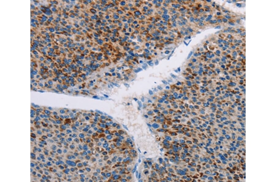 Immunohistochemistry - AMOTL2 Antibody from Signalway Antibody (36101) - Antibodies.com