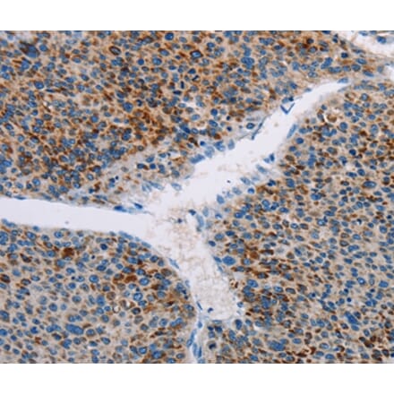 Immunohistochemistry - AMOTL2 Antibody from Signalway Antibody (36101) - Antibodies.com